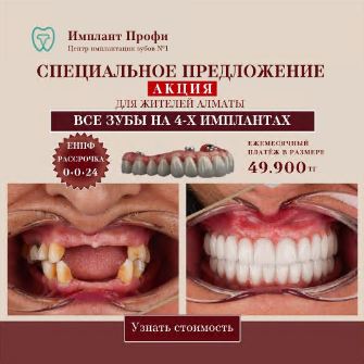 Рекламный креатив All-on-4: до и после протезирования, рассрочка 0-0-24