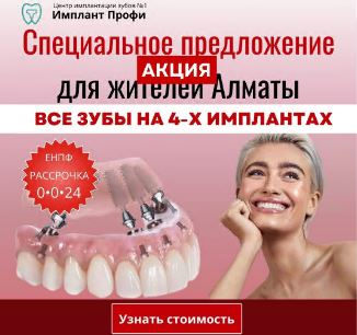 Рекламный креатив All-on-4: специальное предложение для жителей Алматы
