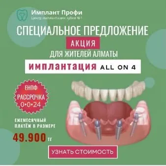 Рекламный креатив All-on-4: схема имплантации и условия рассрочки